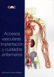 Accesos vasculares. Implantacin y cuidados enfermeros